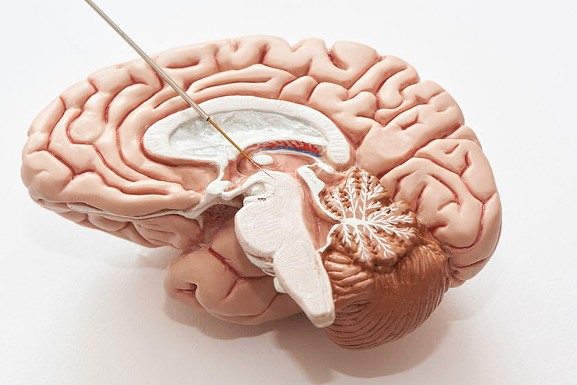Is There A Connection Between Alzheimer's Disease And Parkinson's Disease?